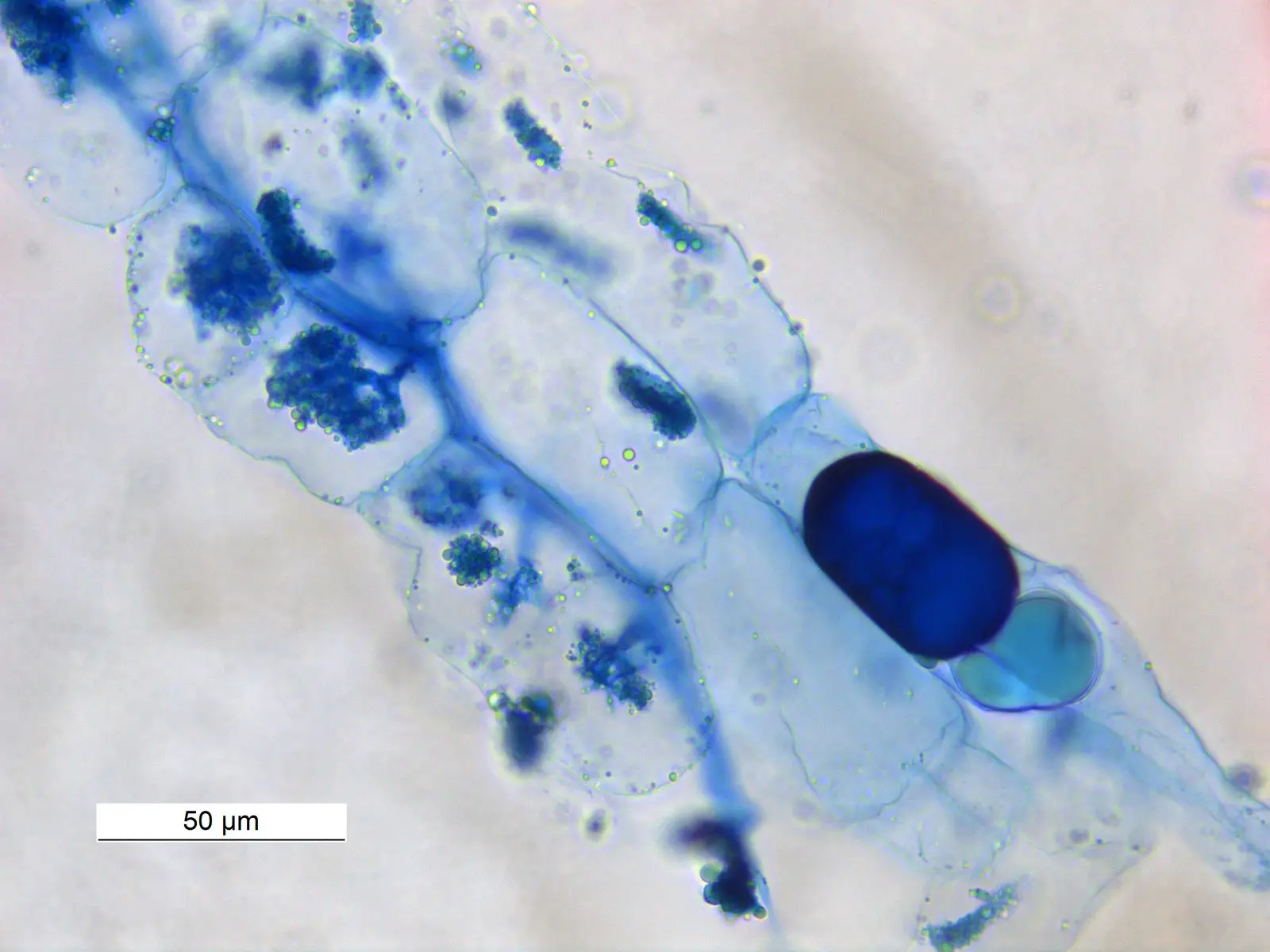 Stained arbuscular mycorrhizal structures inside a plant root, with a 50 micrometre scale bar.